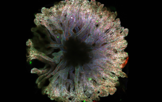 Organoid recapitulating an adult kidney’s collecting duct system.