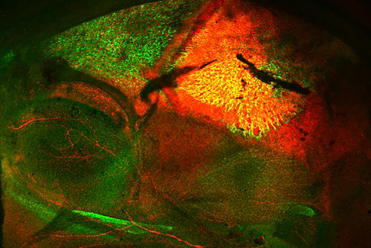 Stem cells at the embryonic coronal suture give rise to cells (red) that are embedded within the bone matrix (green).