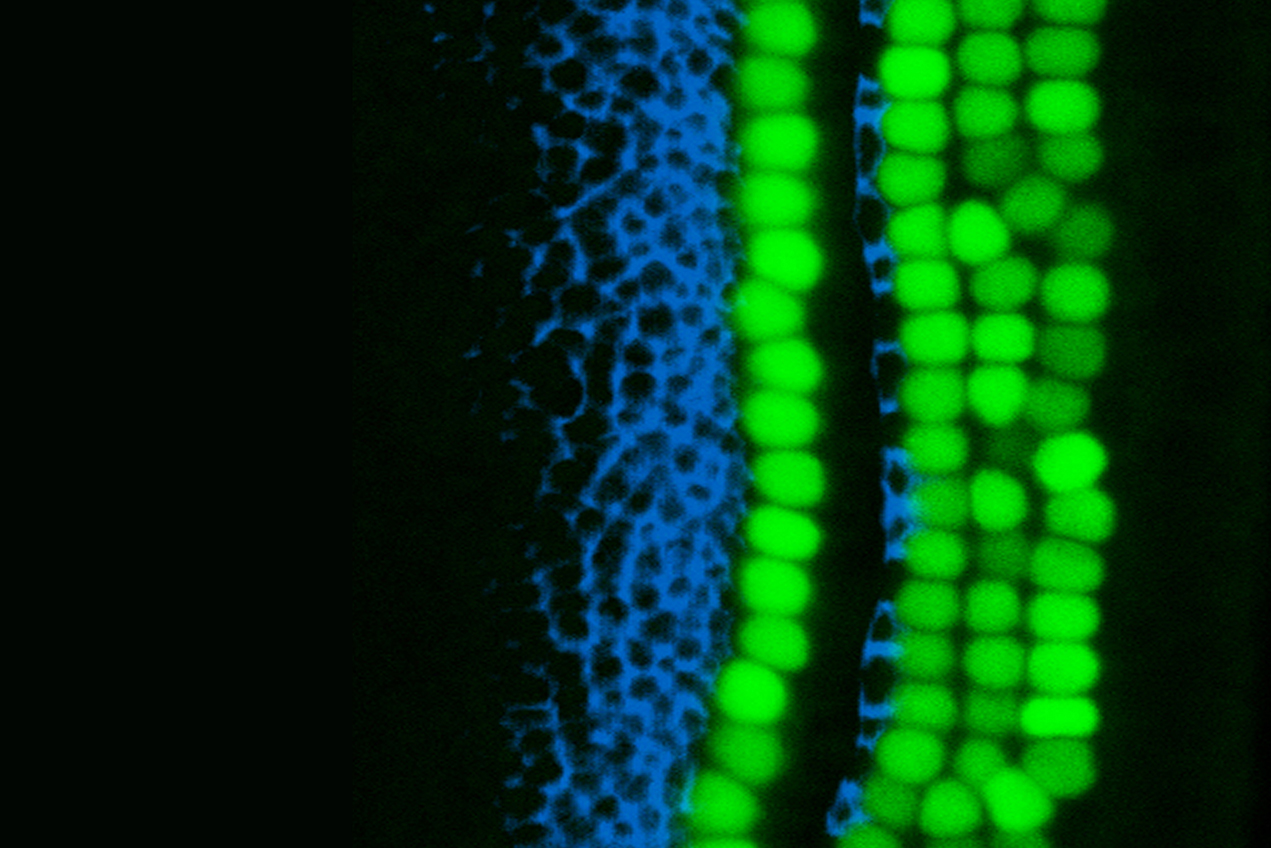 The organ of Corti, the hearing organ of the inner ear, contains rows of sensory hearing cells (green) surrounded by supporting cells (blue).