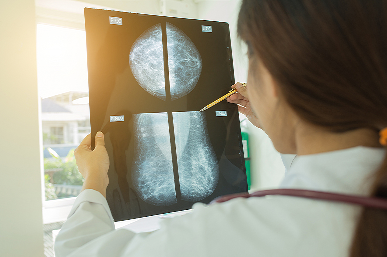 Annual screenings can help detect cancer early, when it's easiest to treat.