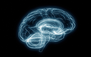 An X-ray shows a human brain.