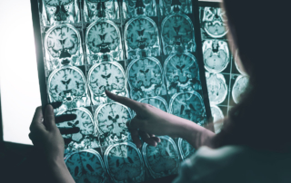 A medical professional points at scans of a person's brain