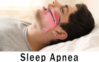 A diagram showing the obstruction that causes sleep apnea overlays the profile of a sleeping man