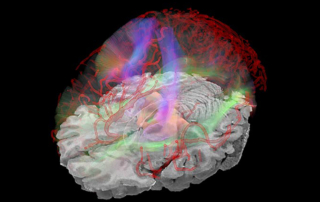 A scientific rendering of the human brain shows an aura of green, red and purple
