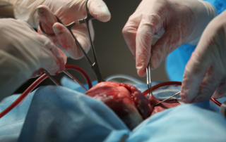 Surgeons' hands perform open heart surgery on a patient