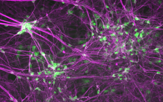 In a scientific rendering, glowing green dots stand out against deep purple fibers.