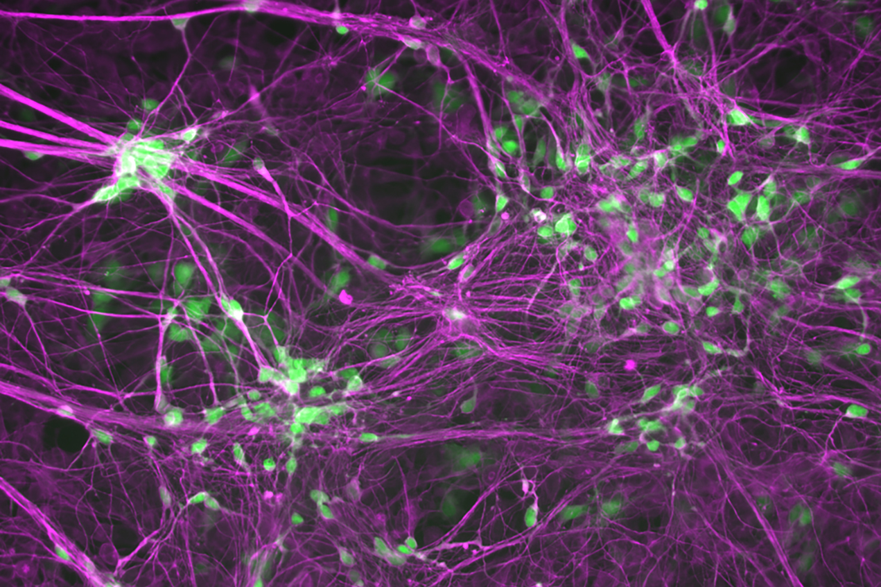 For the first experiment, scientists reprogrammed skin and blood cells taken from ALS patients into motor neurons, which are the main cells damaged by the disease.