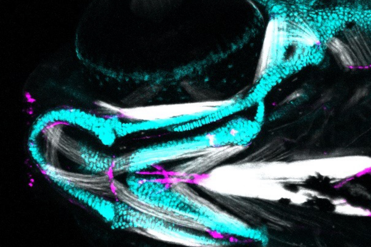 A one-week-old zebrafish's jaw shows three distinct components that develop from a single type of stem cell: cartilage in blue, tendons in magenta and jaw muscles in white. 