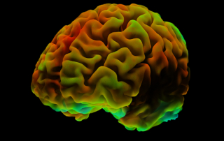 An MRI maps the activity of a healthy brain
