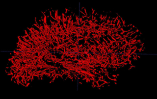 Against a black background, a map of the blood vessels in the brain softly glows red