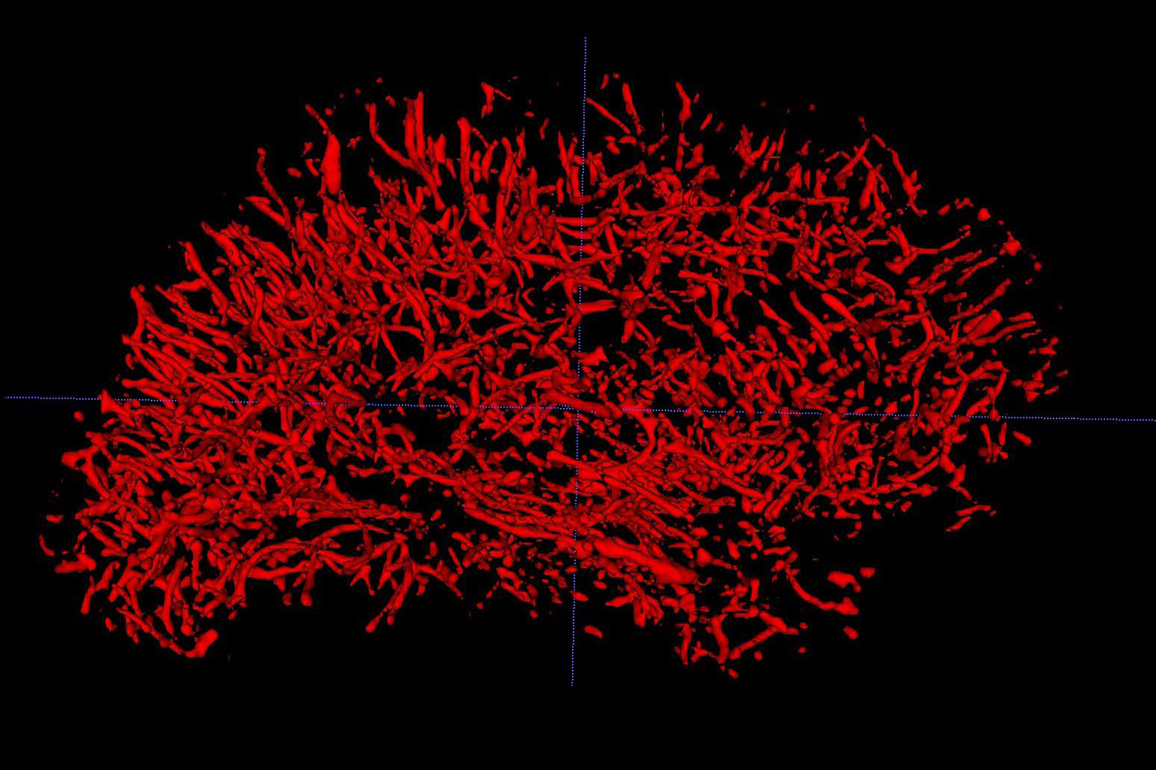 A 3D rendering of small blood vessels throughout a whole brain from a healthy volunteer acquired in eight minutes.