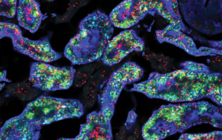 A colorful, microscopic image shows different genes interacting with kidney cells.