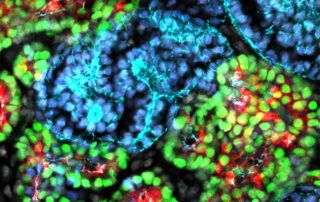 A microscopic view shows hundreds of rounded cells rendered in bright reds, blues and greens.