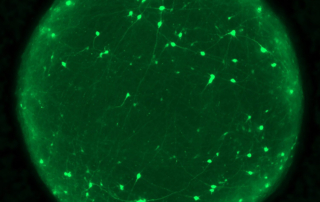 Organoids with neurons labeled in brightly glowing green