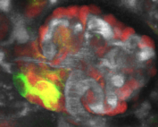 A colorful image shows a kidney's macula densa cell in green and yellow among a network of red and gray