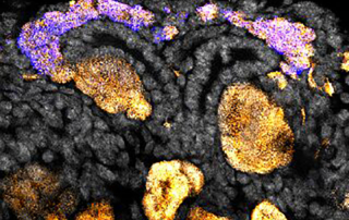 Mouse kidney nephron progenitor cells (purple) forming the developing nephron tubules (yellow) of the kidney’s filtering units, the nephrons