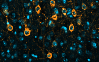 Tau protein in the brain of a mouse with a mutation that causes a common form of dementia