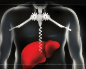 An illustration depicts a liver vulnerable to alcohol-related post-pandemic liver disease