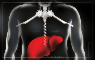 An illustration depicts a liver vulnerable to alcohol-related post-pandemic liver disease
